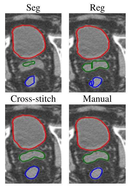 Image depicting AI-powered registration and segmentation of radio images.